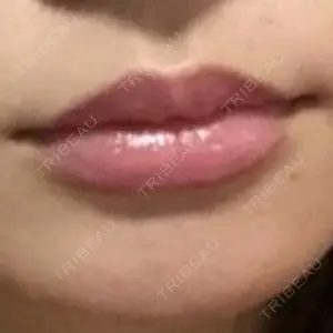 東京美容外科 熊本院口コミ