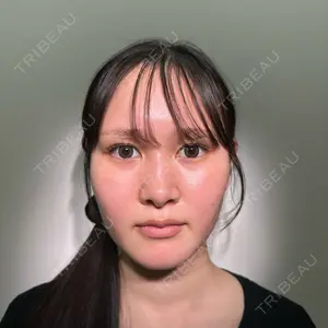 HAAB×DREAM BEAUTY CLINIC 大阪梅田院口コミ