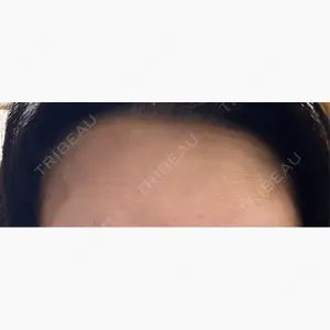 ルラ美容クリニック 名古屋栄院 / ルラスキンクリニック 名古屋栄院口コミ