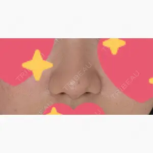 ルラ美容クリニック 新宿院口コミ