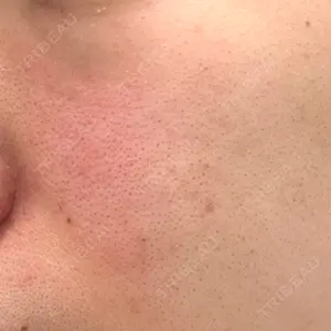 小倉美容外科/美容皮膚科 ビラビューティークリニック口コミ