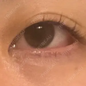 ルラ美容クリニック 静岡院口コミ