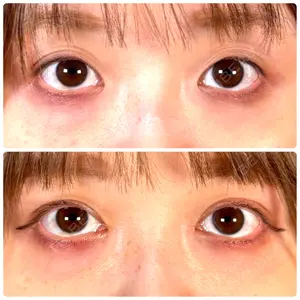 神戸美容外科 ネビュラクリニック口コミ