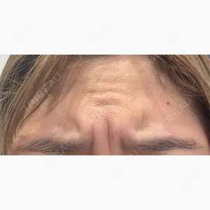 Zetith Beauty Clinic 大阪心斎橋院口コミ