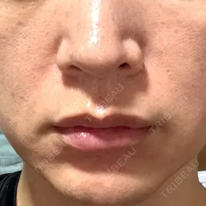 湘南美容クリニック 豊田院口コミ