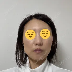 TCB東京中央美容外科 神戸院口コミ