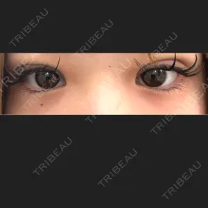 東京シンデレラ美容外科 池袋院口コミ