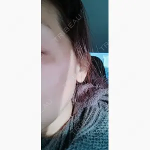 ルラ美容クリニック 郡山院口コミ