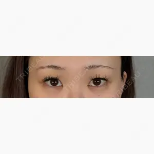 アリエル美容クリニック 大宮院口コミ