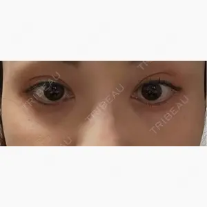 TCB東京中央美容外科 三島院口コミ