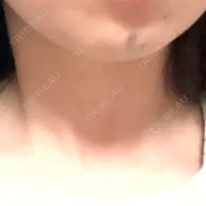 ルラ美容クリニック 福岡天神院口コミ