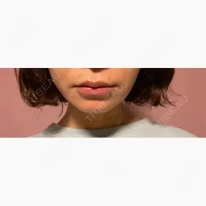 ルラ美容クリニック 郡山院口コミ