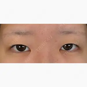 アリエル美容クリニック 大宮院口コミ