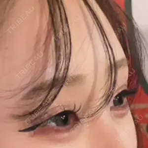 アリエル美容クリニック 郡山院口コミ