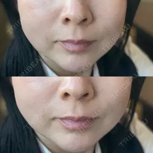 ルラ美容クリニック 大宮院 / ルラスキンクリニック 大宮院口コミ