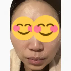 美容皮膚科エルムクリニック 麻布院口コミ