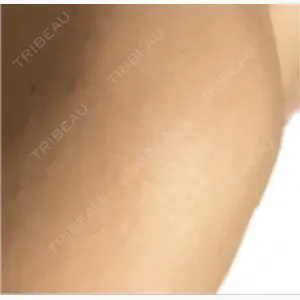 美容皮膚科エルムクリニック 麻布院口コミ