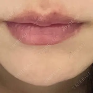 HAAB BEAUTY CLINIC 名古屋院口コミ