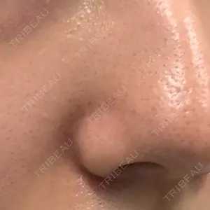 東京シルククリニック 東京神田院口コミ