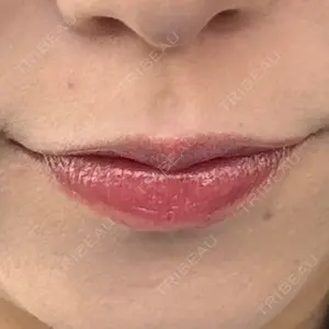 TCB東京中央美容外科 大宮東口院口コミ