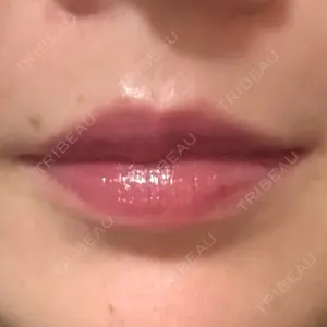 L‘amour clinic Tokyo【ラムールクリニック東京】口コミ