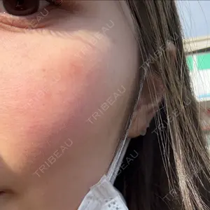 東京シルククリニック 新宿院口コミ