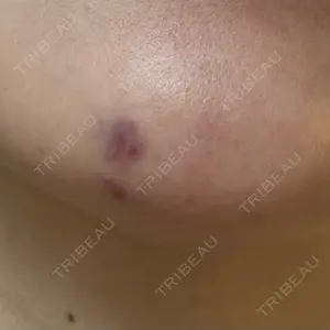 Re:anne clinic 銀座 【リアンクリニック銀座】口コミ