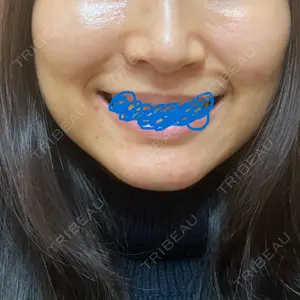 聖心美容クリニック 大阪院口コミ