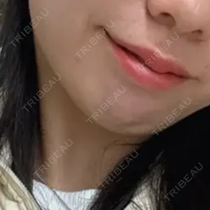 L‘amour clinic Tokyo【ラムールクリニック東京】口コミ