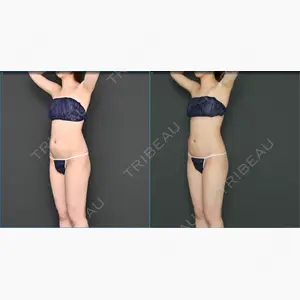 Lipo Clinic omotesando口コミ