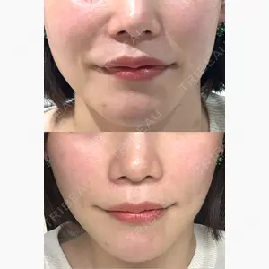 TIAM CLINIC GINZA口コミ