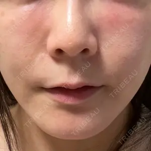 エクラクリニック 大宮口コミ