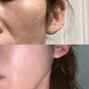 ルラ美容クリニック 札幌本院口コミ