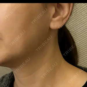 SUNMELIA SKIN CLINIC口コミ