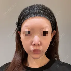 美容皮膚科エルムクリニック 麻布院口コミ