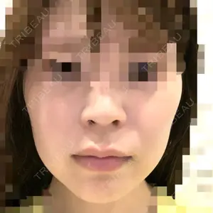 表参道スキンクリニック 大阪院口コミ