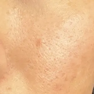 渋谷美容外科クリニック 横浜院口コミ