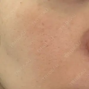 広島本通り美容クリニック口コミ