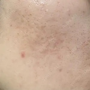 ルラ美容クリニック 広島院口コミ