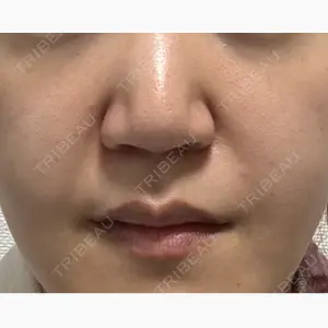 Chloe Cheongdam Clinic （クロエチョンダムクリニック）口コミ