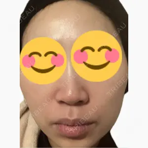 美容皮膚科エルムクリニック 麻布院口コミ