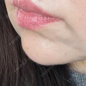 ルラ美容クリニック 新宿院口コミ