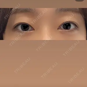 R Beauty CLINIC 銀座院口コミ