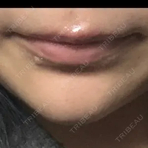 ルラ美容クリニック 岡山院口コミ