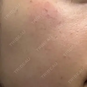 ルラ美容クリニック 神戸院口コミ