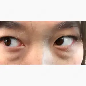 三鷹はなふさ皮膚科口コミ