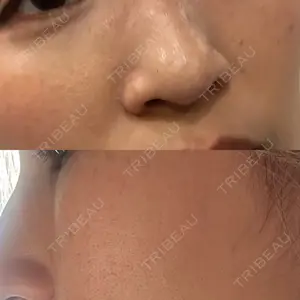 ルラ美容クリニック 札幌大通り院口コミ