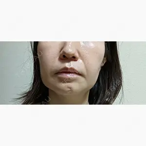 BIZENNクリニック【ビゼンクリニック】口コミ