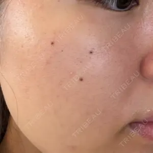 ライズワン美容皮膚科クリニック口コミ