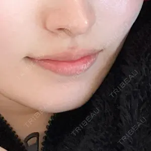 Next Tokyo Clinic口コミ